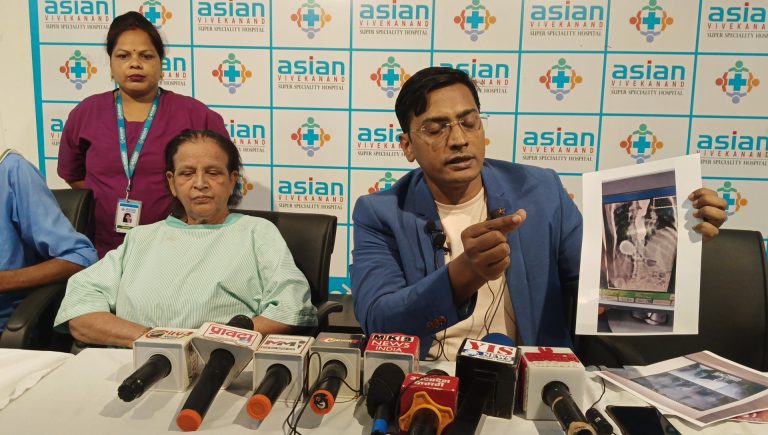 एशियन विवेकानंद अस्पताल में एकेलेसिया कार्डिया जैसी खतरनाक बीमारी का सफल ऑपरेशन PER ORAL ENDOSCOPY MAYOTOMY (POEM )  किया गया