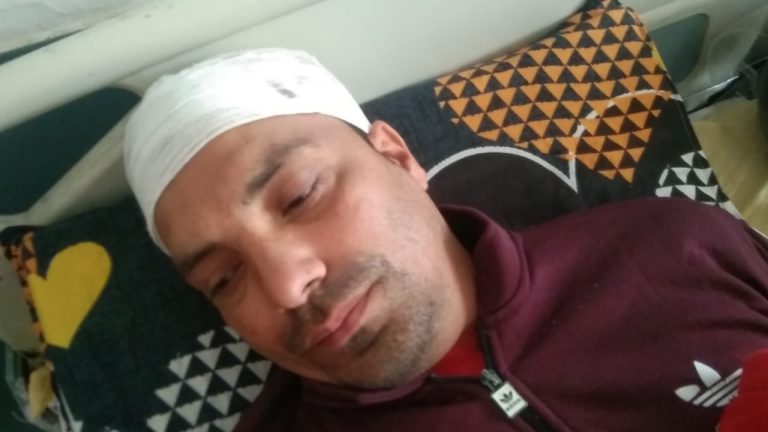 पैसे के लेनदेन को लेकर दो पक्ष आपस में भिडे, दो युवक गंभीर रूप से घायल ,पुलिस ने किया मुकदमा दर्ज